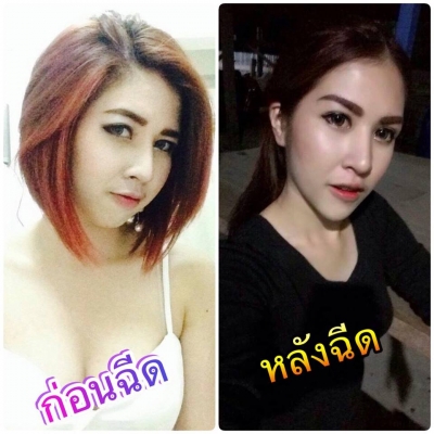 ร้อยไหม 8มิติ หน้าสวยครบวงจร แบบไม่เขียว ไม่ช่ำ หน้าเป๊ะเวอร์ 081-713-3783 ร้อยไหม 8มิติ หน้าสวยครบวงจร แบบไม่เขียว ไม่ช่ำ หน้าเป๊ะเวอร์ 081-713-3783