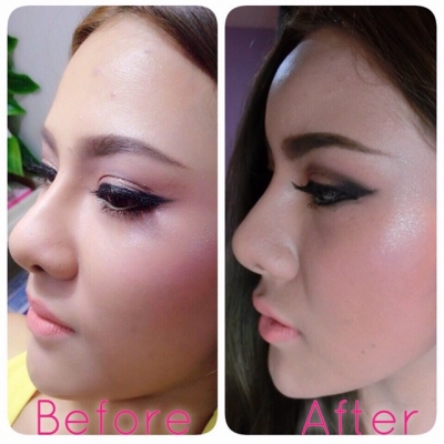 ร้อยไหม 8มิติ หน้าสวยครบวงจร แบบไม่เขียว ไม่ช่ำ หน้าเป๊ะเวอร์ 081-713-3783 ร้อยไหม 8มิติ หน้าสวยครบวงจร แบบไม่เขียว ไม่ช่ำ หน้าเป๊ะเวอร์ 081-713-3783