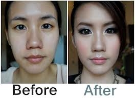 โปรโมรชั้น Veser Lipo ร้อยไหม 7มิติ สเตมเซลล์ 089-816-5225