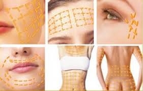Veser liposelectอัพหน้าอกอิ่มสวย  Premuim- QSW Veser ฉีดเสริมหน้าอก 089-816-5225