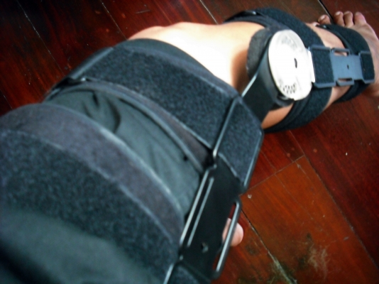 สนับป้องกันเข่า ROM Knee Brace 22&quot; 57120 Conwell