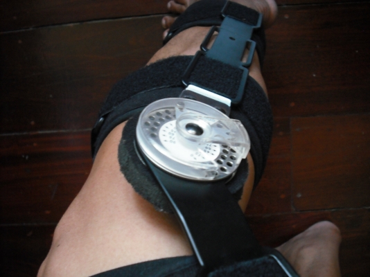 สนับป้องกันเข่า ROM Knee Brace 22&quot; 57120 Conwell