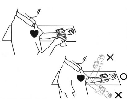 เครื่องวัดความดันโลหิตแบบพกพา