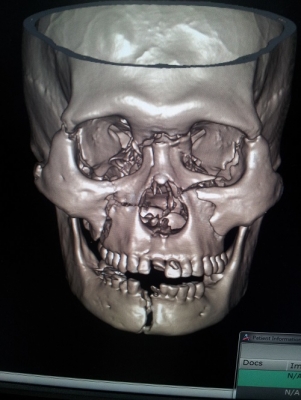 เปืย  badboys pataya mc ขายทิ้ง yamaha dragstar 1100 cc ทะเบียนแท้ ขาย85000