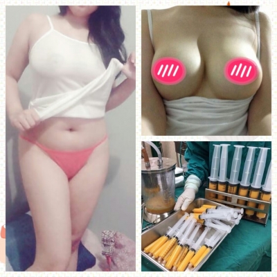 สถาบันเสริมความงามครบวงจร ฉีดเสริมหน้าอก 081-713-3783