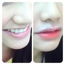 สถาบันเสริมความงามครบวงจร ฉีดเสริมหน้าอก 081-713-3783 สถาบันเสริมความงามครบวงจร ฉีดเสริมหน้าอก 081-713-3783