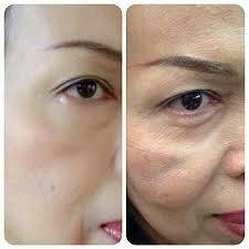 ** รับสมัคร"ตัวแทนจำหน่าย" กำไรจากการขายปลีก 500-1000 บ/ชิ้น ** รับสมัคร"ตัวแทนจำหน่าย" กำไรจากการขายปลีก 500-1000 บ/ชิ้น