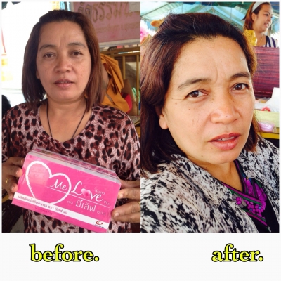 ** รับสมัคร"ตัวแทนจำหน่าย" กำไรจากการขายปลีก 500-1000 บ/ชิ้น ** รับสมัคร"ตัวแทนจำหน่าย" กำไรจากการขายปลีก 500-1000 บ/ชิ้น