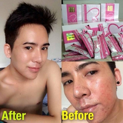 ** รับสมัคร"ตัวแทนจำหน่าย" กำไรจากการขายปลีก 500-1000 บ/ชิ้น ** รับสมัคร"ตัวแทนจำหน่าย" กำไรจากการขายปลีก 500-1000 บ/ชิ้น