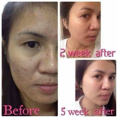 รับตัวแทนจำหน่าย...รับไปเลยต่อชิ้น..⏩.1000 บาท