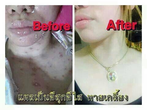 รับตัวแทนจำหน่าย...รับไปเลยต่อชิ้น..⏩.1000 บาท