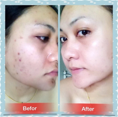 รับตัวแทนจำหน่าย...รับไปเลยต่อชิ้น..⏩.1000 บาท