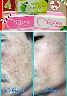 รับตัวแทนจำหน่าย...รับไปเลยต่อชิ้น..⏩.1000 บาท