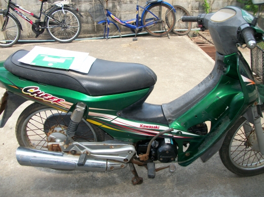 ชายถูก kawasaki cheer
