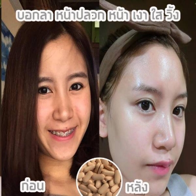 รุกฆาตผิวขาวใน7วัน กลูต้าของแท้ หน้าเด้งหน้าเรียว สมุนไพรยาสอด เห็นผลเร็วมากกก