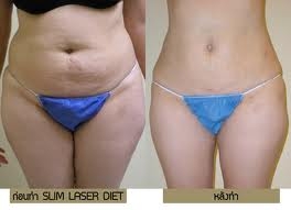 ฉีดเสริมหน้าอก โบทอกหน้าเรียว ร้อยไหม 4 มิติ ไหมทองคำ IPL ลบฝ้า 081-713-3783 ฉีดเสริมหน้าอก โบทอกหน้าเรียว ร้อยไหม 4 มิติ ไหมทองคำ IPL ลบฝ้า 081-713-3783