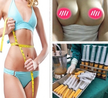 ร้อยไหมสเต็มเซลล์ Premuim- QSW Veser-SLBD สลายไขมัน  ฉีดเสริมหน้าอก 0827078761