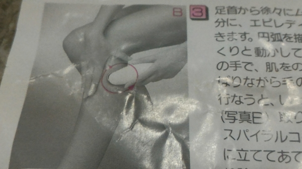 เครื่องถอดกำจัด ยี่ห้อ EPILADY ของประเทศ อิสราเอล เป็นแบบใช้การทำงานของสปริงในการหดรัด ทำงานได้เร็วไม่มีคมไม่มีอันตรายจาการโดนบาด