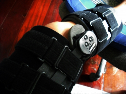 สนับป้องกันเข่า